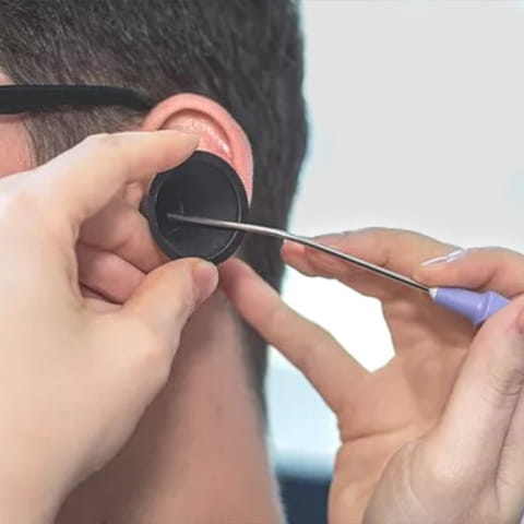 microsuction procedure